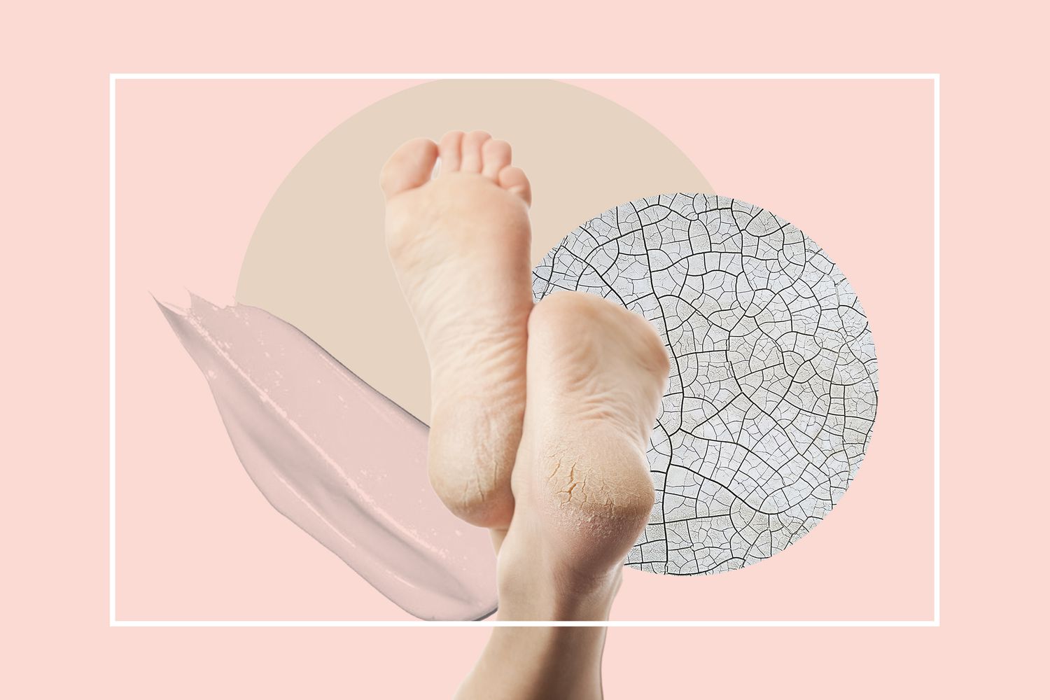 چگونه با ترک های پا مقابله کنیم؟